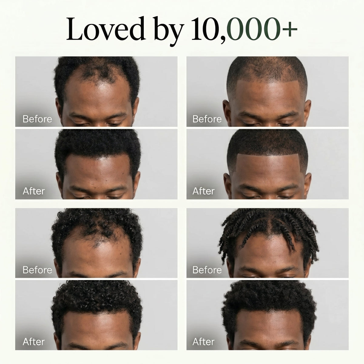 Korean Hair Growth Bar for Men