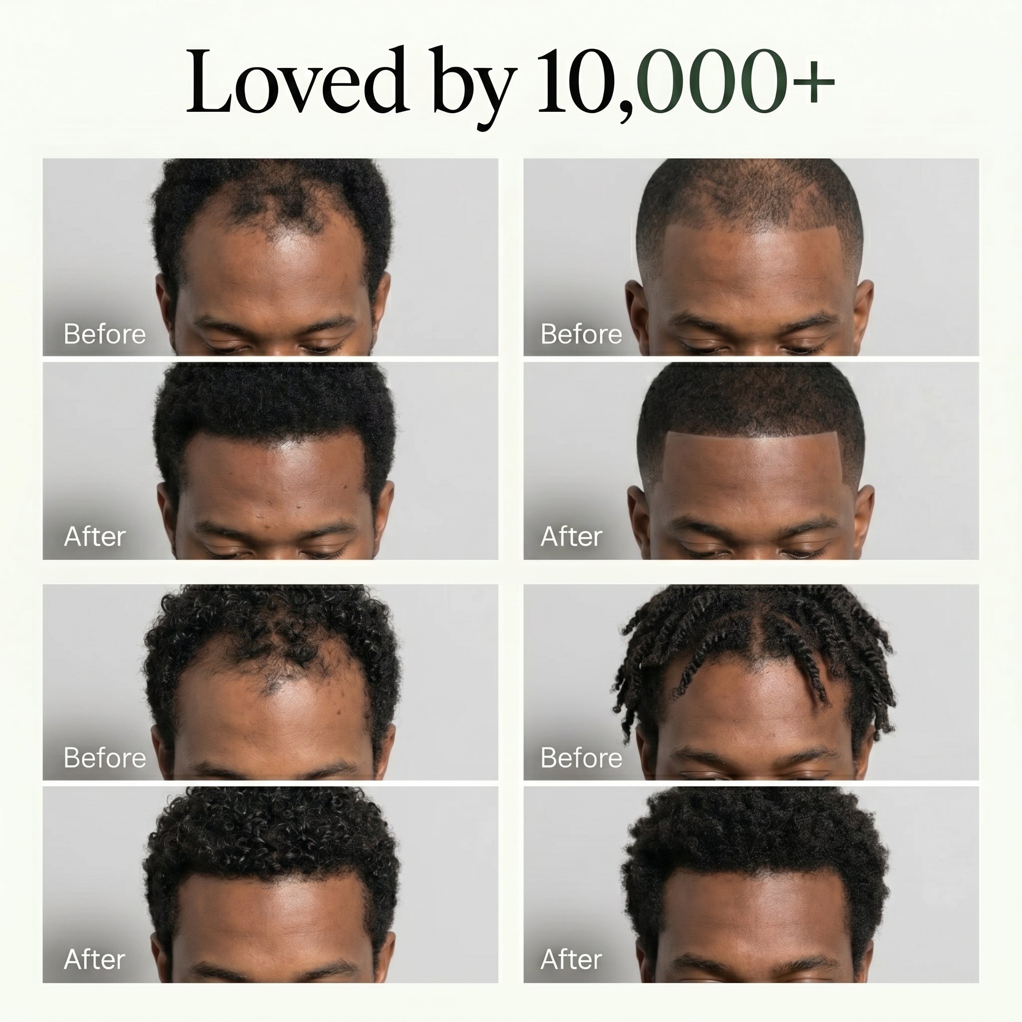 Korean Hair Growth Bar for Men