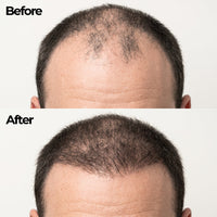 Korean Hair Growth Bar for Men