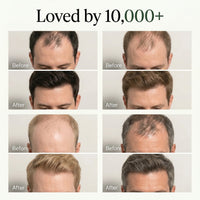 Korean Hair Growth Bar for Men