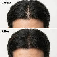 Korean Scalp Revival Bar For Men
