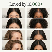Korean Scalp Revival Bar S