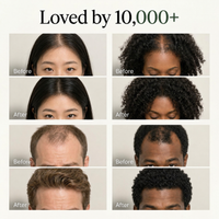 The Korean Scalp Revival Bar